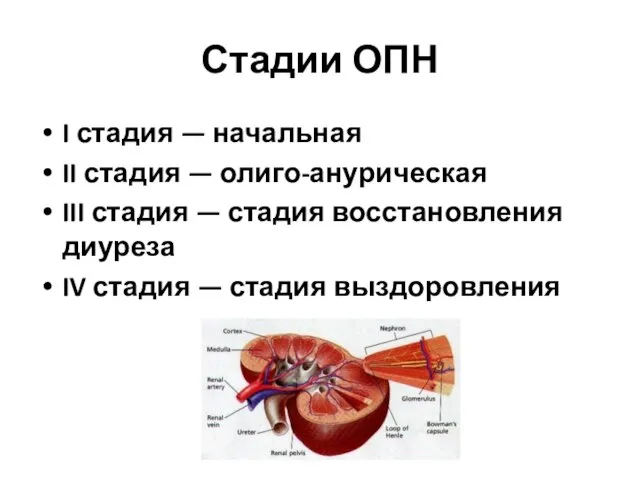 Стадии ОПН I стадия — начальная II стадия — олиго-анурическая III стадия