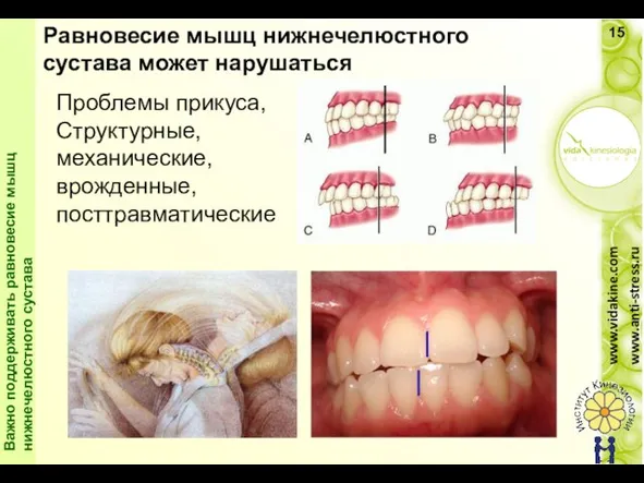 Problemas de oclusión. Problemas estructurales y mecánicos congénitos u postraumáticos. Равновесие мышц