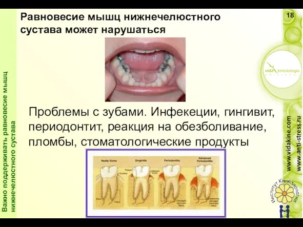 Проблемы с зубами. Инфекеции, гингивит, периодонтит, реакция на обезболивание, пломбы, стоматологические продукты