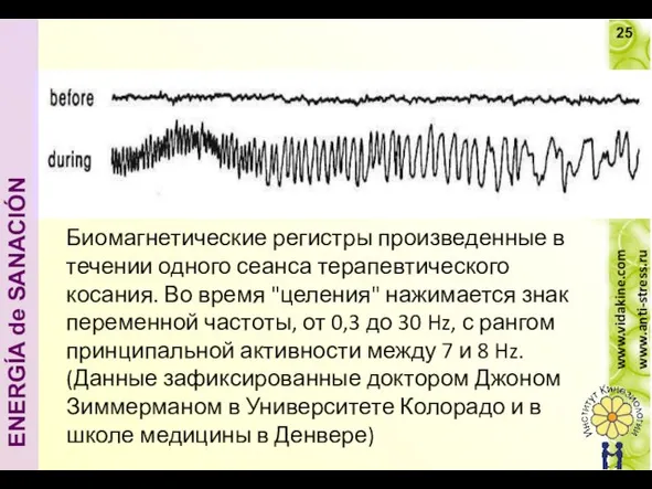 Биомагнетические регистры произведенные в течении одного сеанса терапевтического косания. Во время "целения"