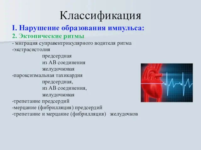 Классификация I. Нарушение образования импульса: 2. Эктопические ритмы - миграция суправентрикулярного водителя