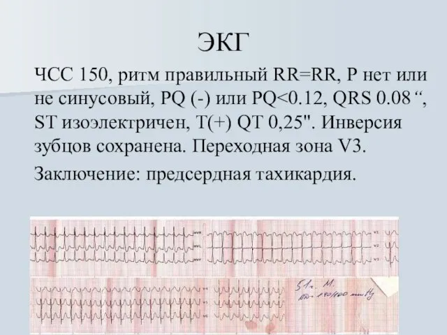 ЭКГ ЧСС 150, ритм правильный RR=RR, Р нет или не синусовый, PQ