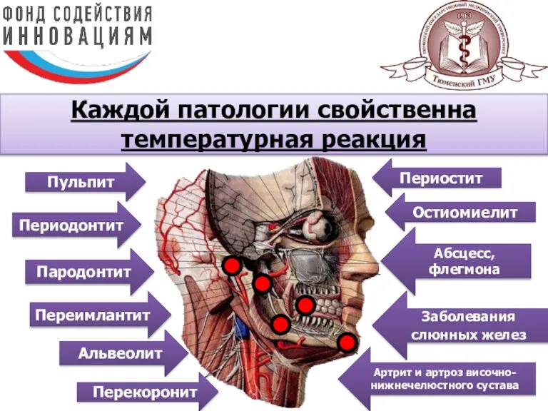 Каждой патологии свойственна температурная реакция Пульпит Периодонтит Пародонтит Переимлантит Альвеолит Перекоронит Периостит