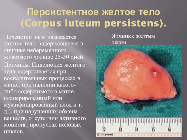 Персистентное желтое тело (Corpus luteum persistens). Персистентным называется желтое тело, задержавшееся в