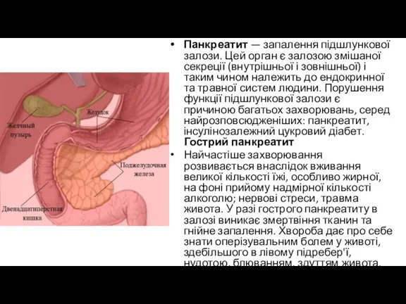 Панкреатит — запалення підшлункової залози. Цей орган є залозою змішаної секреції (внутрішньої