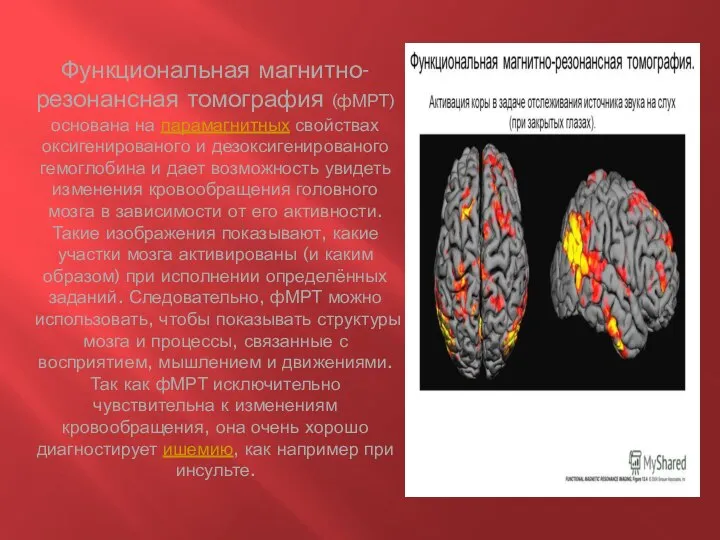 Функциональная магнитно-резонансная томография (фМРТ) основана на парамагнитных свойствах оксигенированого и дезоксигенированого гемоглобина