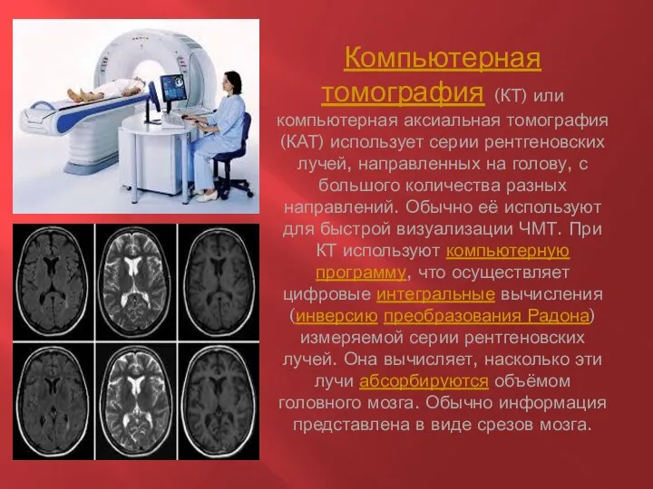 Компьютерная томография (КТ) или компьютерная аксиальная томография (КАТ) использует серии рентгеновских лучей,