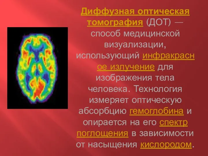 Диффузная оптическая томография (ДОТ) — способ медицинской визуализации, использующий инфракрасное излучение для