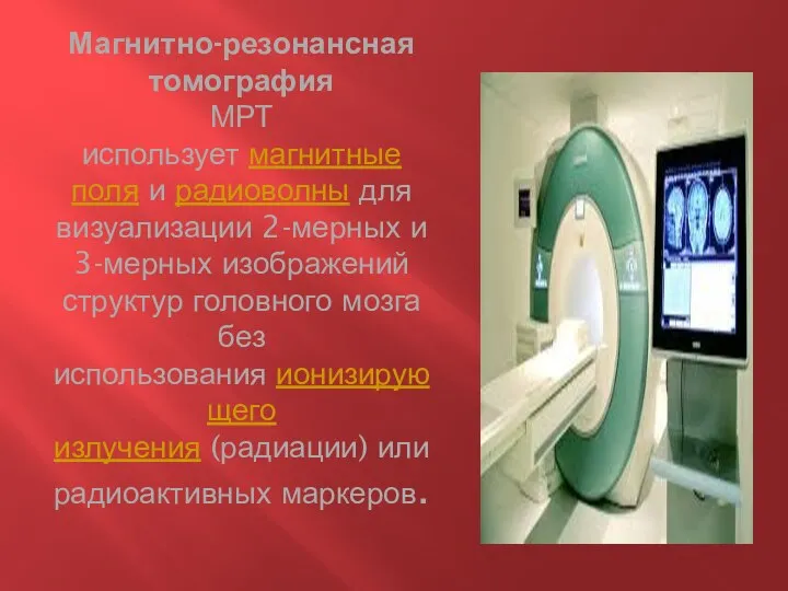 Магнитно-резонансная томография МРТ использует магнитные поля и радиоволны для визуализации 2-мерных и