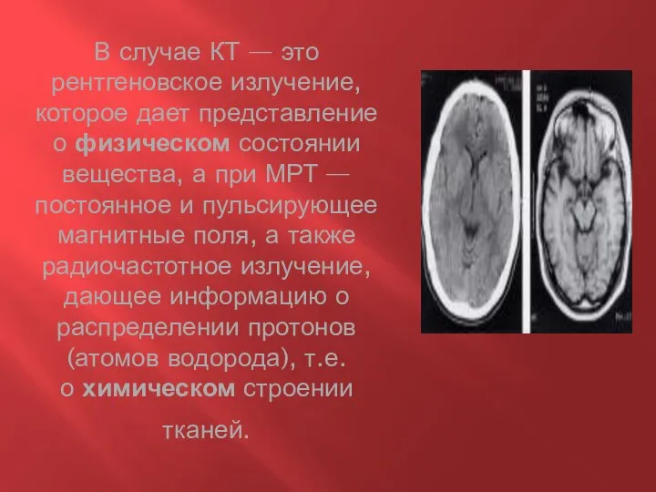 В случае КТ — это рентгеновское излучение, которое дает представление о физическом