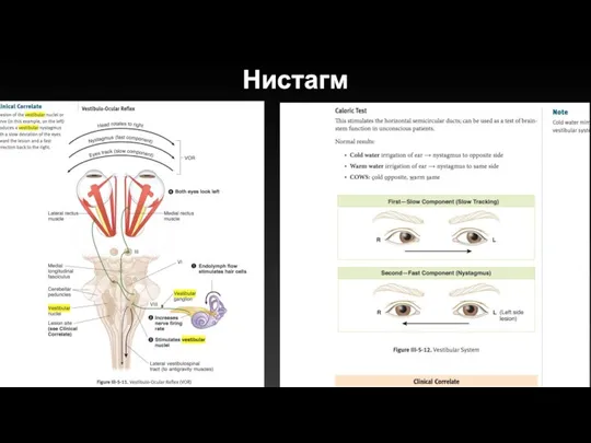 Нистагм