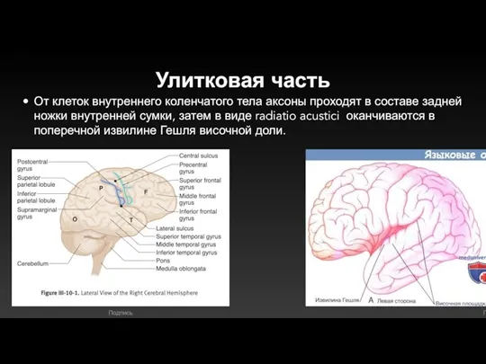 Улитковая часть От клеток внутреннего коленчатого тела аксоны проходят в составе задней