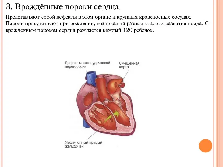 3. Врождённые пороки сердца. Представляют собой дефекты в этом органе и крупных