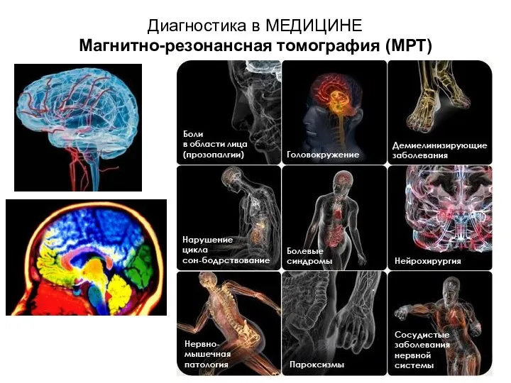 Диагностика в МЕДИЦИНЕ Магнитно-резонансная томография (МРТ)