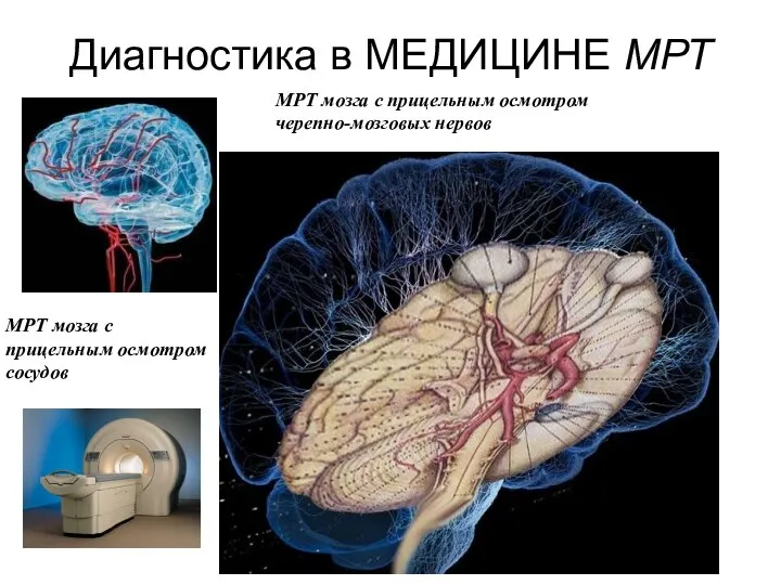 Диагностика в МЕДИЦИНЕ МРТ МРТ мозга с прицельным осмотром черепно-мозговых нервов МРТ