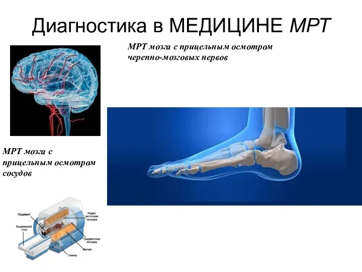 Диагностика в МЕДИЦИНЕ МРТ МРТ мозга с прицельным осмотром черепно-мозговых нервов МРТ