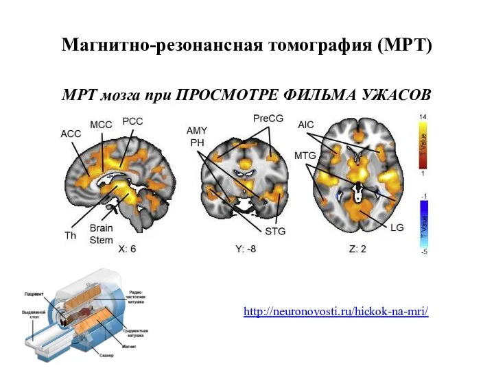 МРТ мозга при ПРОСМОТРЕ ФИЛЬМА УЖАСОВ Магнитно-резонансная томография (МРТ) http://neuronovosti.ru/hickok-na-mri/