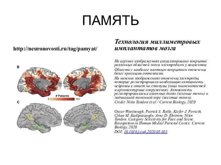 ПАМЯТЬ http://neuronovosti.ru/tag/pamyat/ Технология миллиметровых имплантатов мозга На верхних изображениях визуализировано покрытие различных