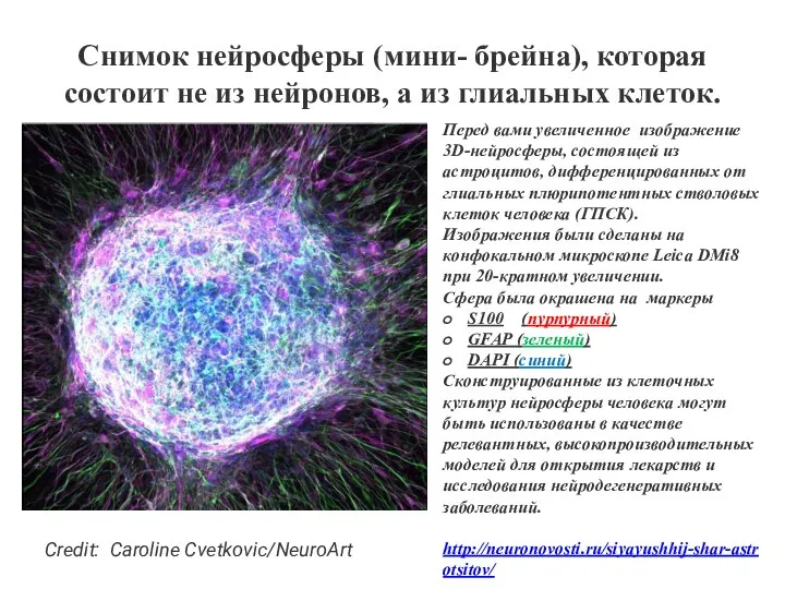 Снимок нейросферы (мини- брейна), которая состоит не из нейронов, а из глиальных