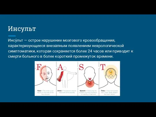 Инсульт Инсу́льт — острое нарушение мозгового кровообращения, характеризующееся внезапным появлением неврологической симптоматики,