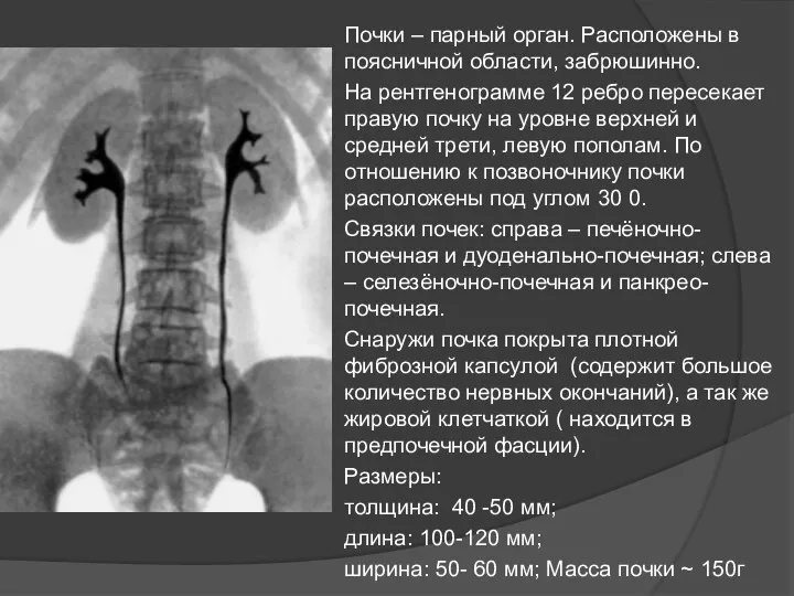 Почки – парный орган. Расположены в поясничной области, забрюшинно. На рентгенограмме 12