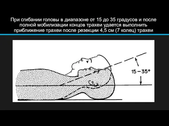 При сгибании головы в диапазоне от 15 до 35 градусов и после