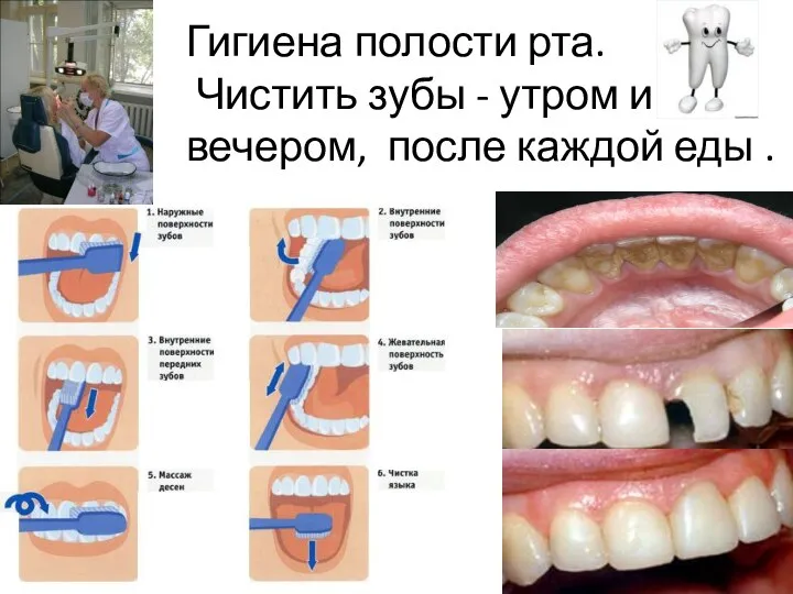 Гигиена полости рта. Чистить зубы - утром и вечером, после каждой еды .