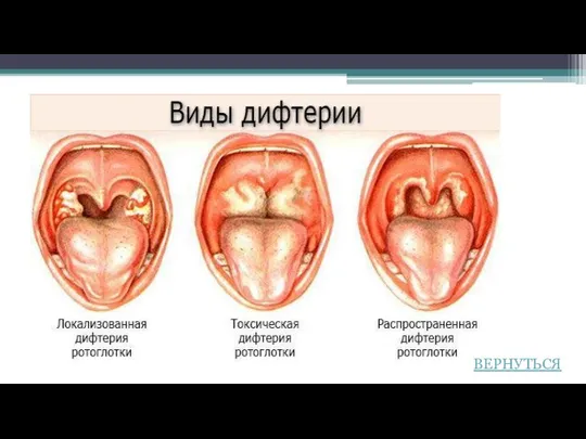 ВЕРНУТЬСЯ