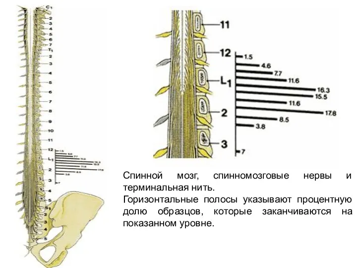 Спинной мозг, спинномозговые нервы и терминальная нить. Горизонтальные полосы указывают процентную долю