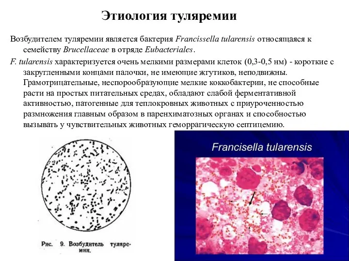 Этиология туляремии Возбудителем туляремии является бактерия Francissella tularensis относящаяся к семейству Brucellaceae