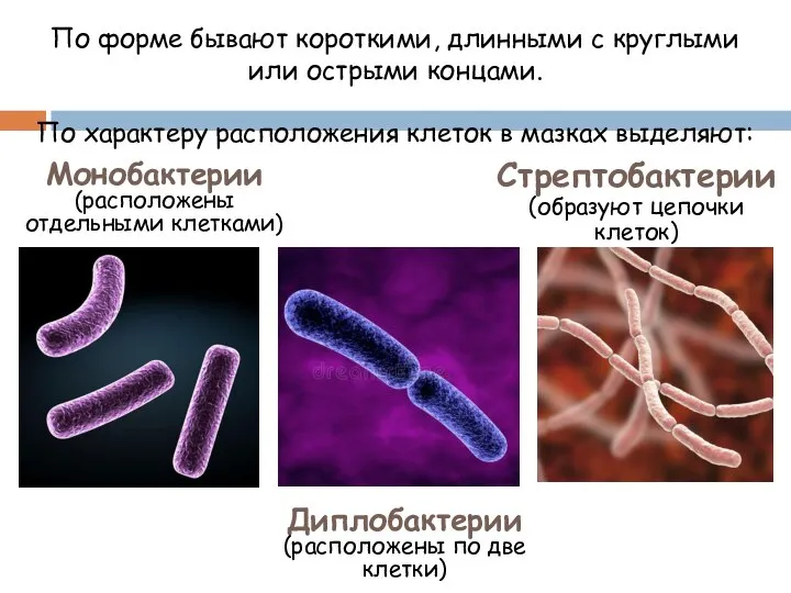 По форме бывают короткими, длинными с круглыми или острыми концами. По характеру