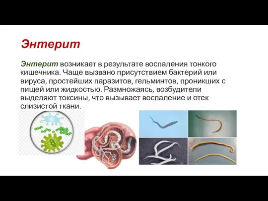 Энтерит Энтерит возникает в результате воспаления тонкого кишечника. Чаще вызвано присутствием бактерий