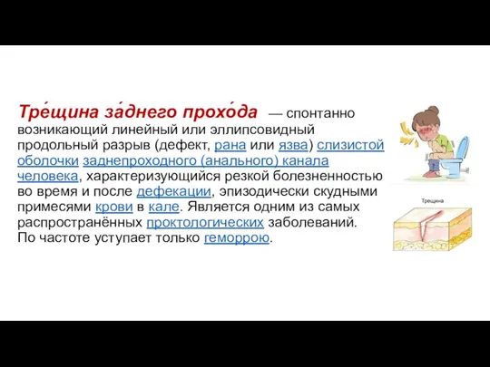 Тре́щина за́днего прохо́да — спонтанно возникающий линейный или эллипсовидный продольный разрыв (дефект,