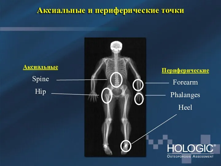 Аксиальные и периферические точки Периферические Forearm Phalanges Heel Аксиальные Spine Hip