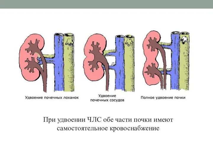 При удвоении ЧЛС обе части почки имеют самостоятельное кровоснабжение