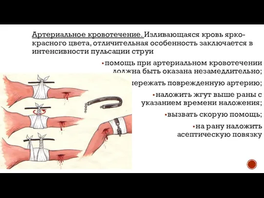 Артериальное кровотечение. Изливающаяся кровь ярко-красного цвета, отличительная особенность заключается в интенсивности пульсации