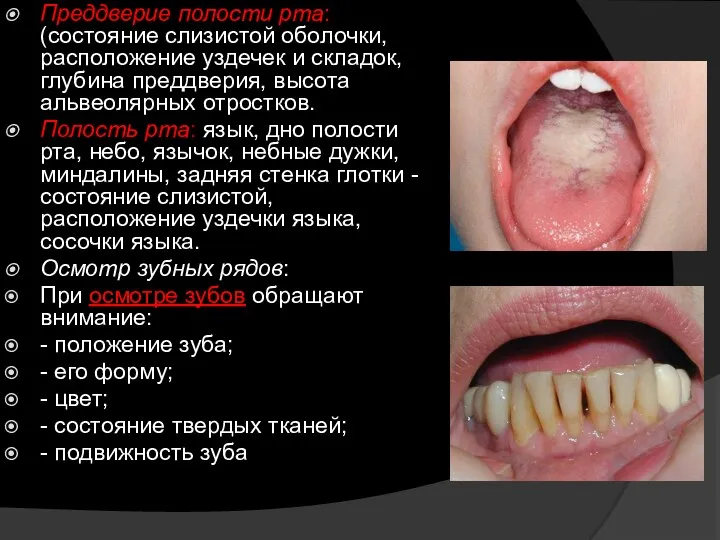 Преддверие полости рта: (состояние слизистой оболочки, расположение уздечек и складок, глубина преддверия,