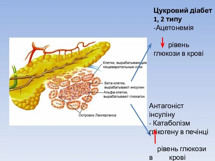 Цукровий діабет 1, 2 типу -Ацетонемія рівень глюкози в крові Антагоніст інсуліну
