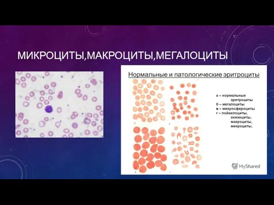 МИКРОЦИТЫ,МАКРОЦИТЫ,МЕГАЛОЦИТЫ