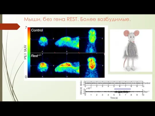 Мыши, без гена REST. Более возбудимые.