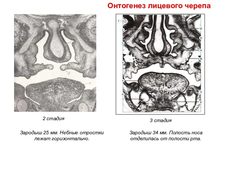 3 стадия 2 стадия Зародыш 25 мм. Небные отростки лежат горизонтально. Зародыш