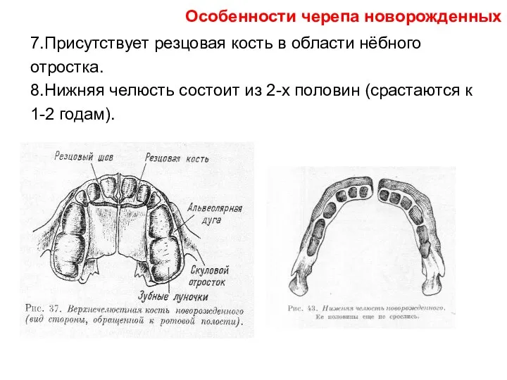 7.Присутствует резцовая кость в области нёбного отростка. 8.Нижняя челюсть состоит из 2-х