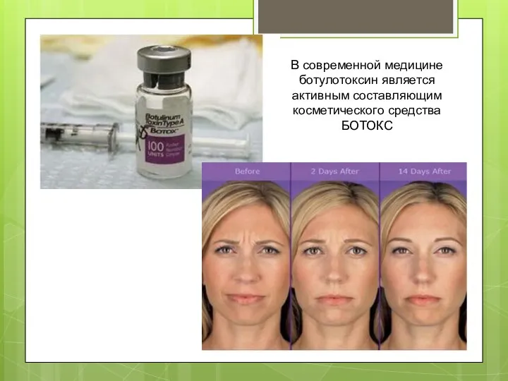 В современной медицине ботулотоксин является активным составляющим косметического средства БОТОКС
