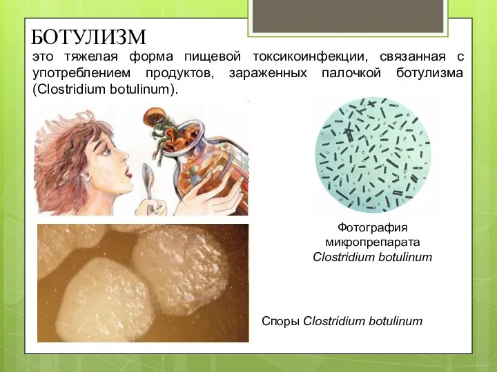 Споры Clostridium botulinum Фотография микропрепарата Clostridium botulinum это тяжелая форма пищевой токсикоинфекции,