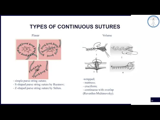 TYPES OF CONTINUOUS SUTURES Planar Volume - simple purse string suture; -