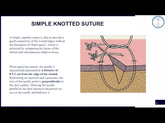 SIMPLE KNOTTED SUTURE A simple separate suture is able to provide a