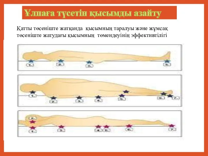 Қатты төсеніште жатқанда қысымның таралуы және жұмсақ төсеніште жатудағы қысымның төмендеуінің эффективтілігі