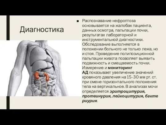 Диагностика Распознавание нефроптоза основывается на жалобах пациента, данных осмотра, пальпации почки, результатах