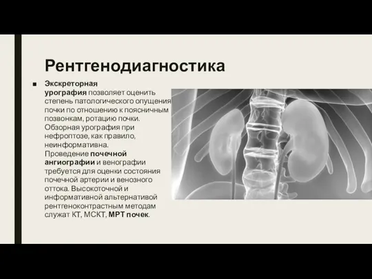 Рентгенодиагностика Экскреторная урография позволяет оценить степень патологического опущения почки по отношению к