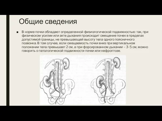 Общие сведения В норме почки обладают определенной физиологической подвижностью: так, при физическом